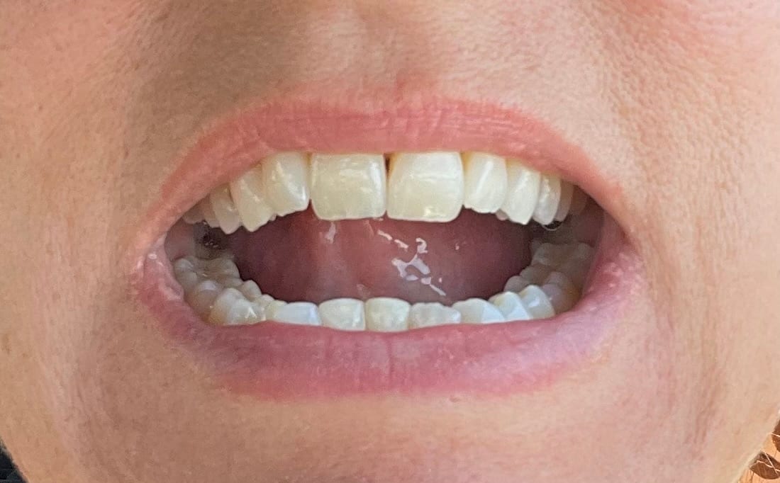 Timber Falls Family Dentistry, photo 3