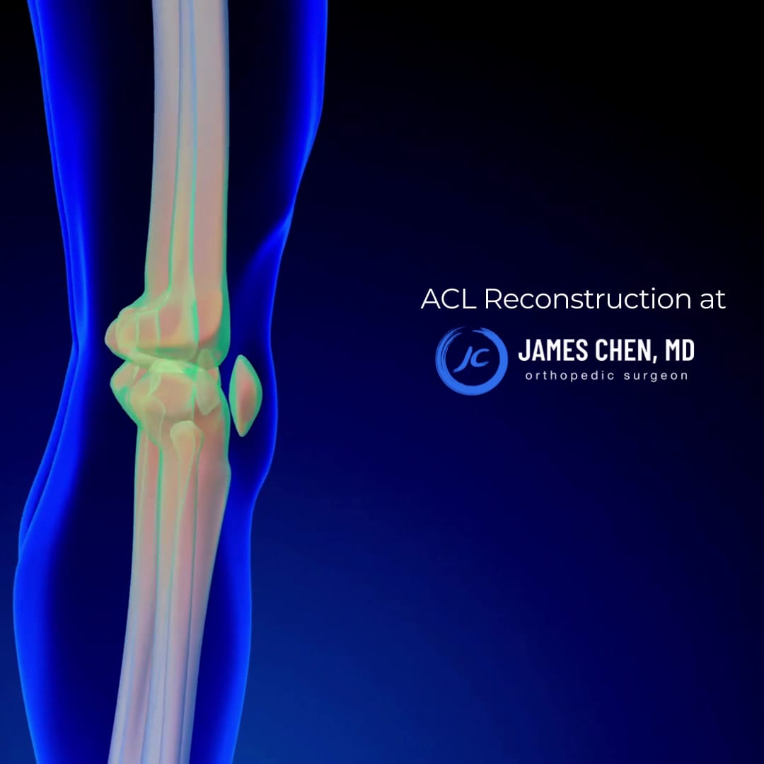James Chen, MD | Orthopedic Surgeon in San Francisco, photo 3