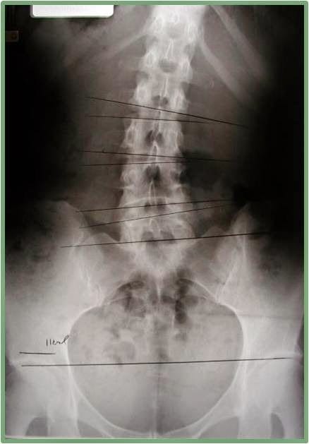 AZ ChiroCare - Dr. Robert E. Street, photo 4