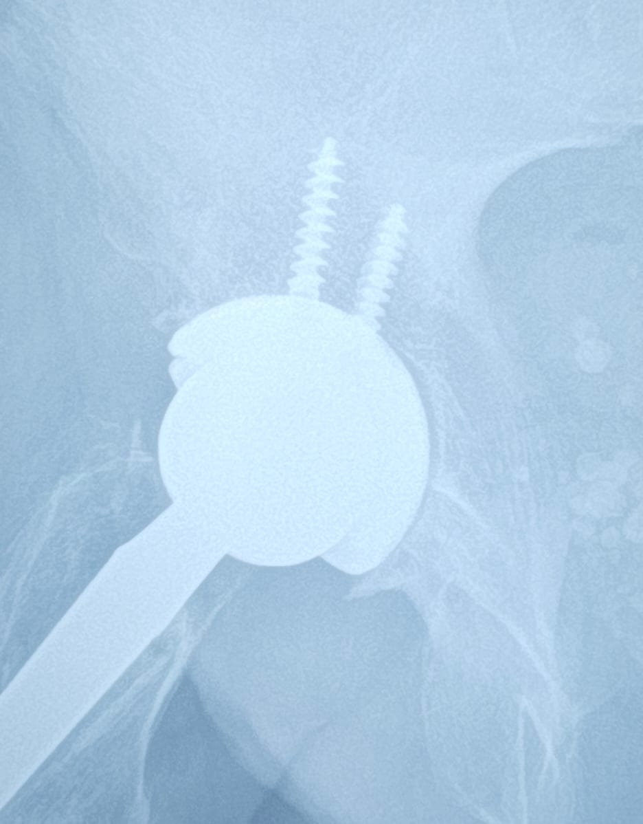 Coon Joint Replacement Institute, photo 3