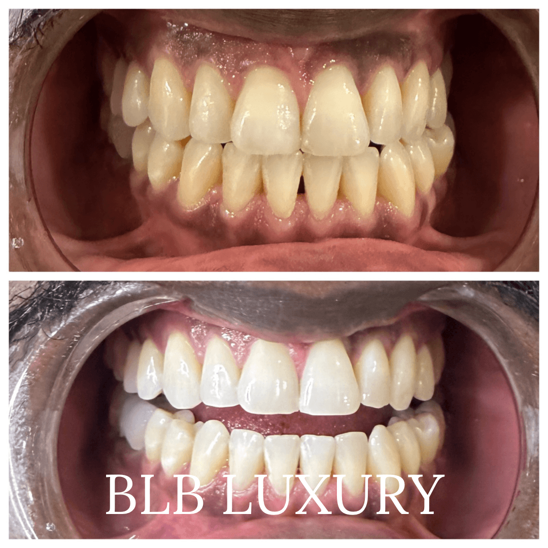 BLB LUXURY