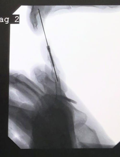Fitzmaurice Hand Institute, photo 2