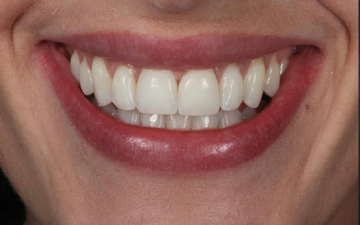 Ruh Dental - Fleet St