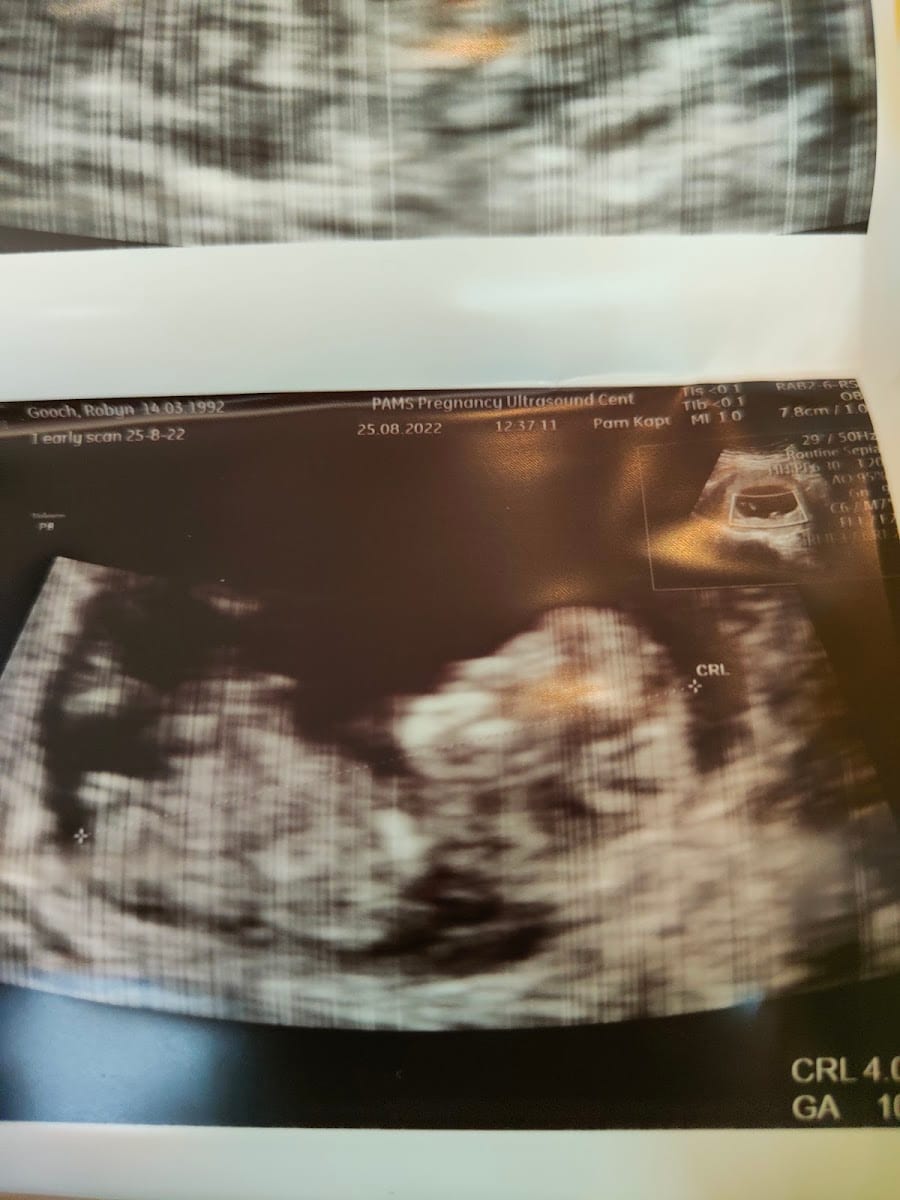 PAMS Pregnancy Ultrasound Centre, photo 4
