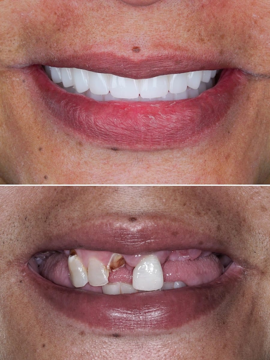 Eleve Dental Cosmetic & Implant Center, photo 2