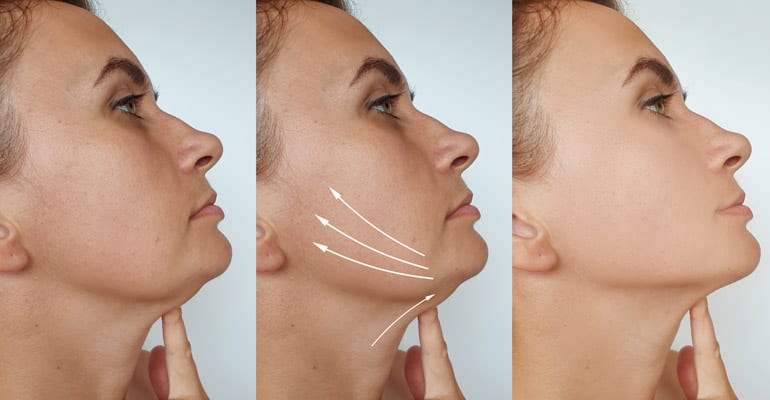Ava Laser Clinic By Anna, photo 4
