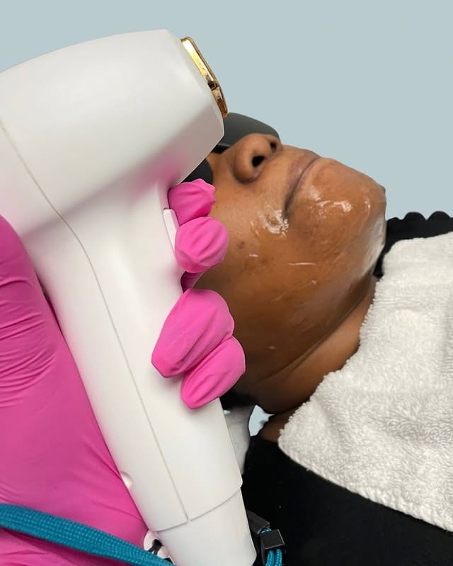 Dermapure Sherwood Park