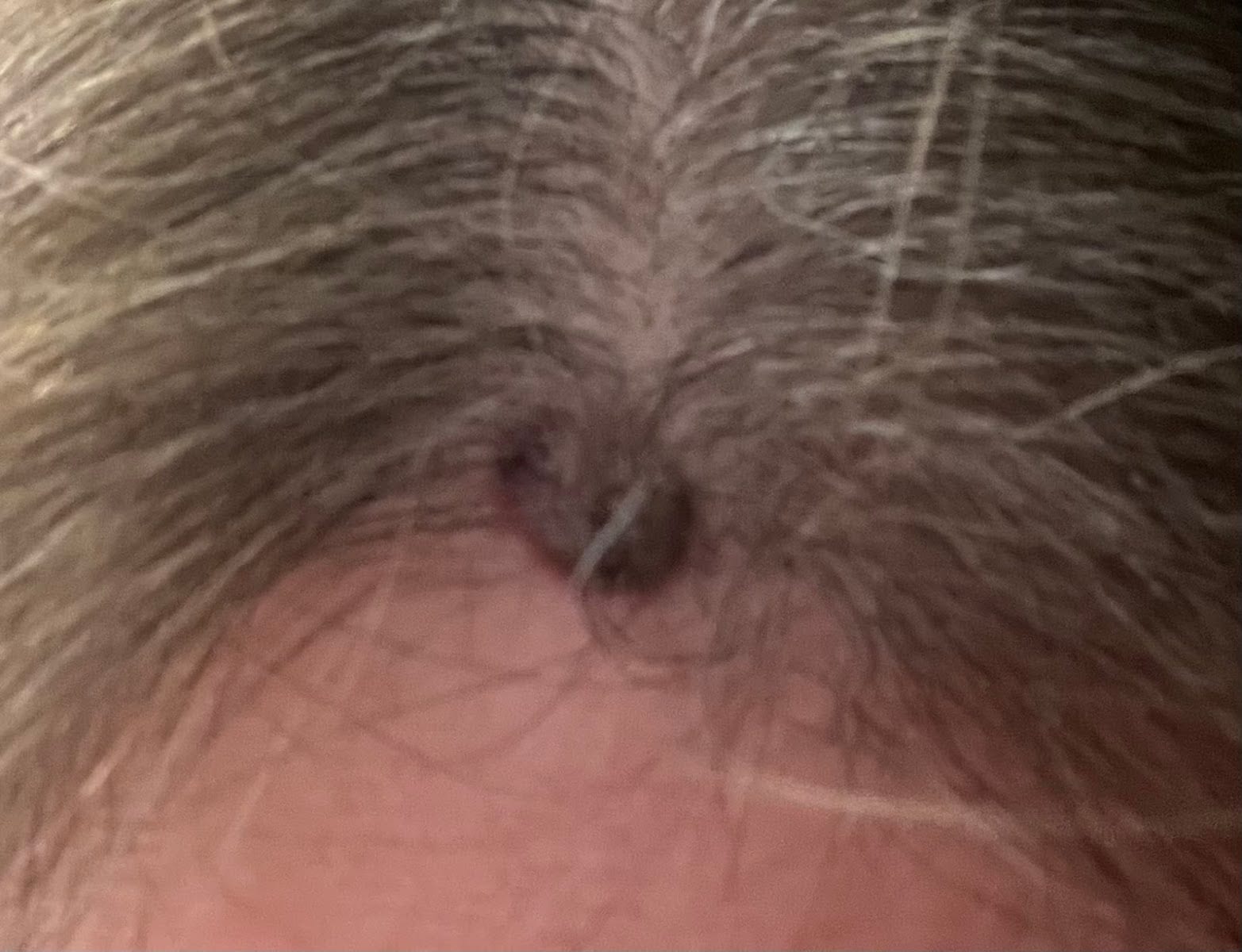Jennifer L. Hobbs, MD