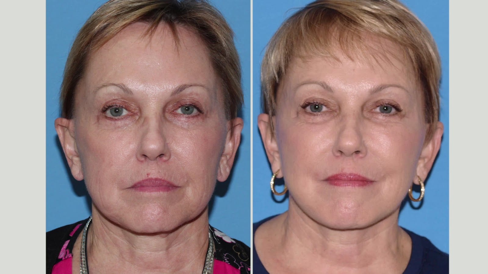 Diepenbrock Facial Cosmetic Surgery, photo 2