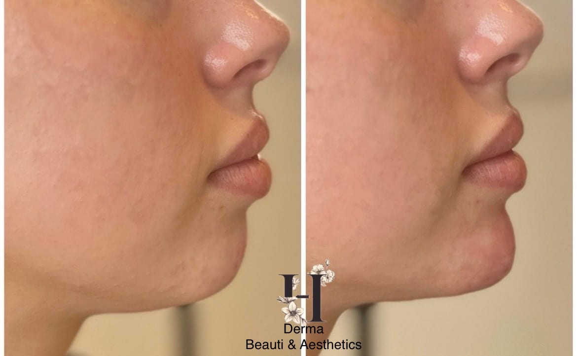 H Derma Beauti & Aesthetics, photo 2