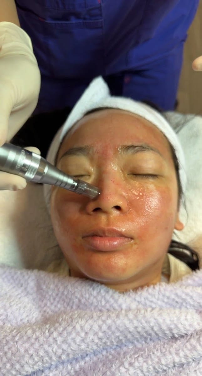 Beautiful Youth Facials, photo 3