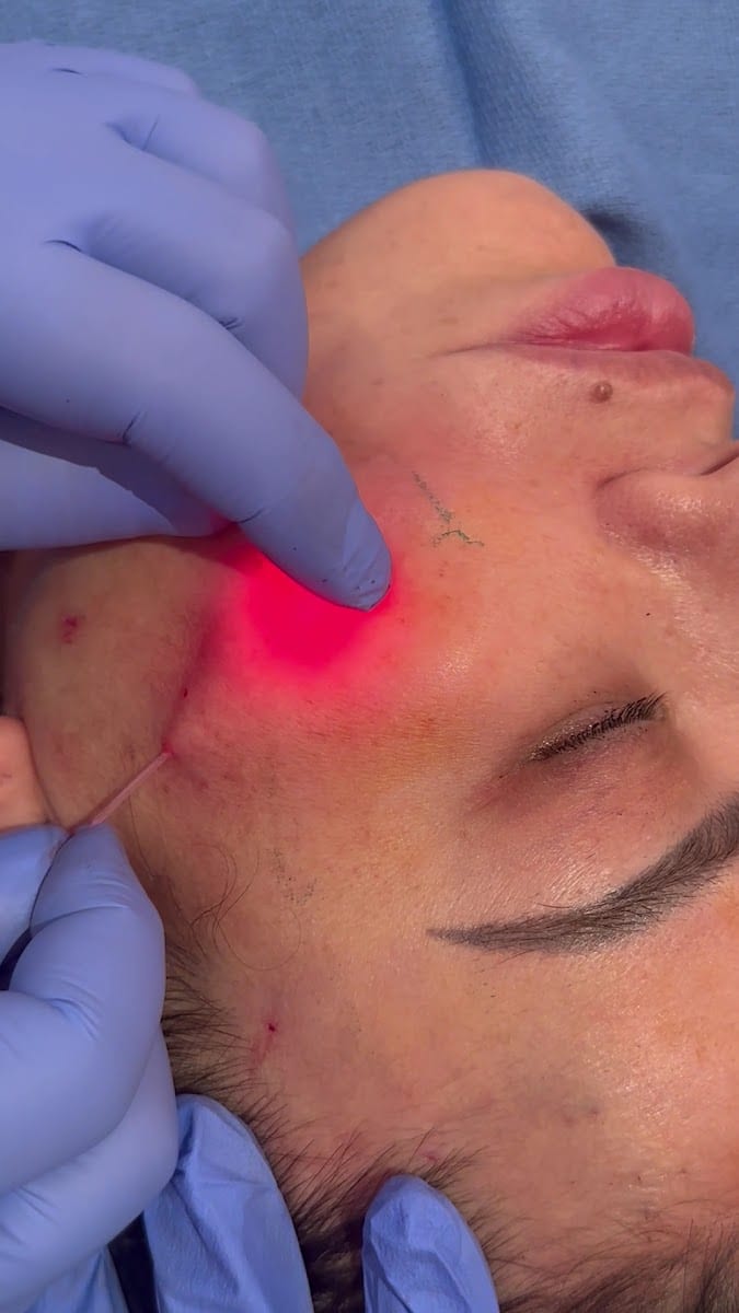 La Belle Medical Spa Tustin CA, photo 4