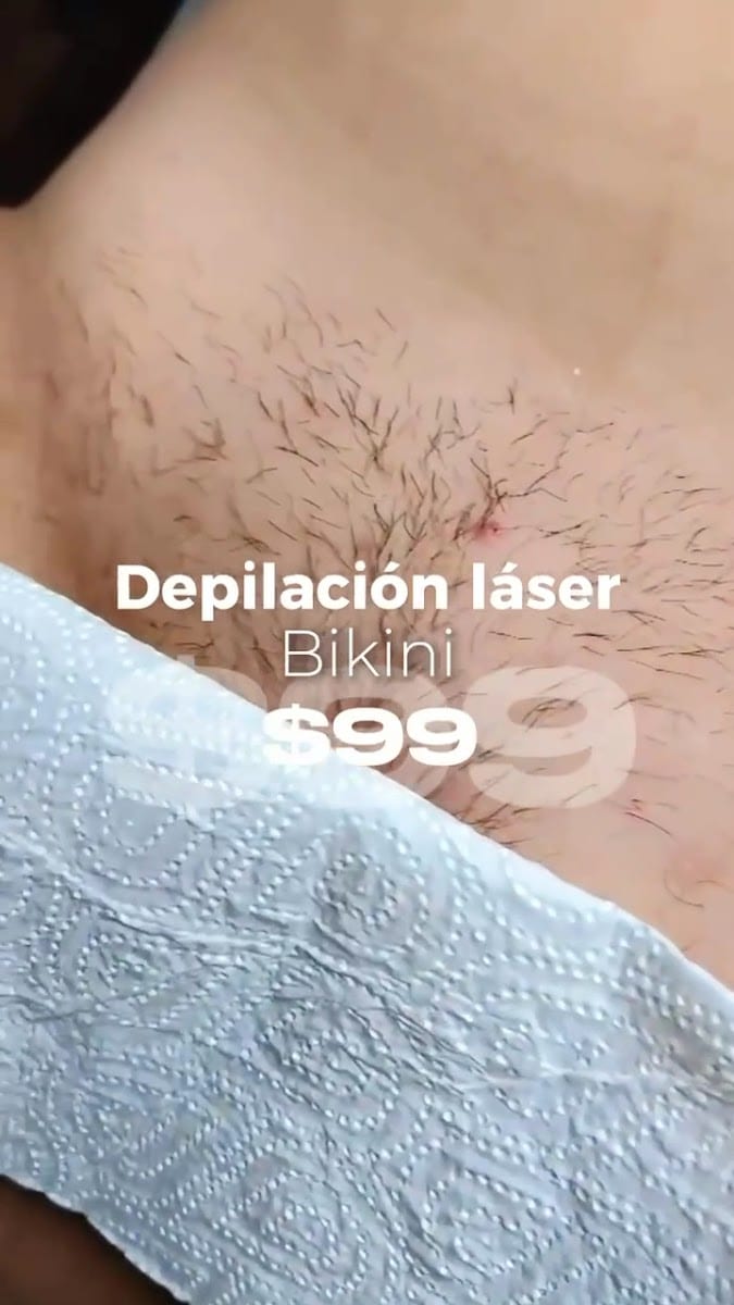 ARG Beauty | Laser Hair Removal in Sarasota, photo 3