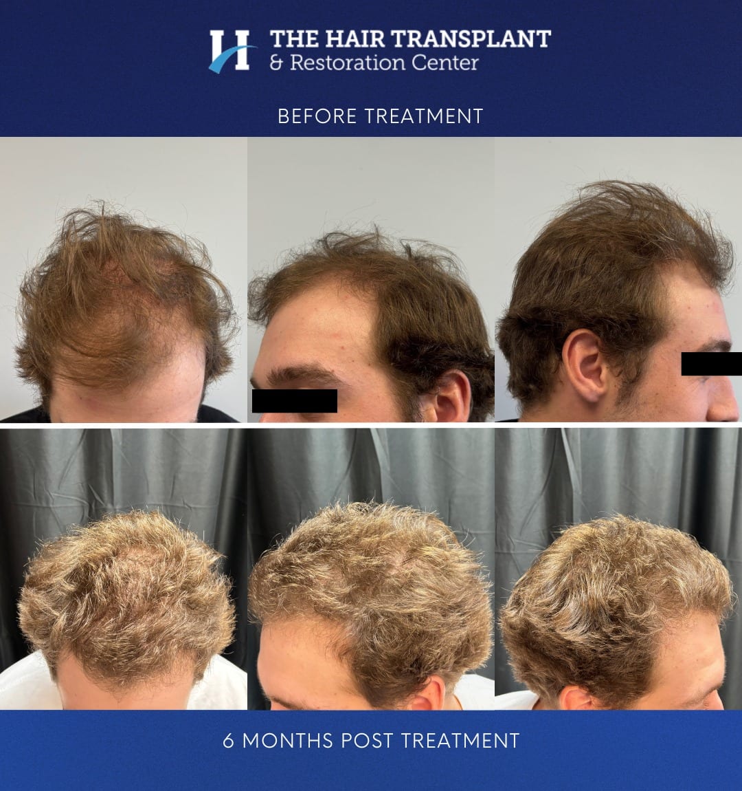 The Hair Transplant & Restoration Center, photo 4