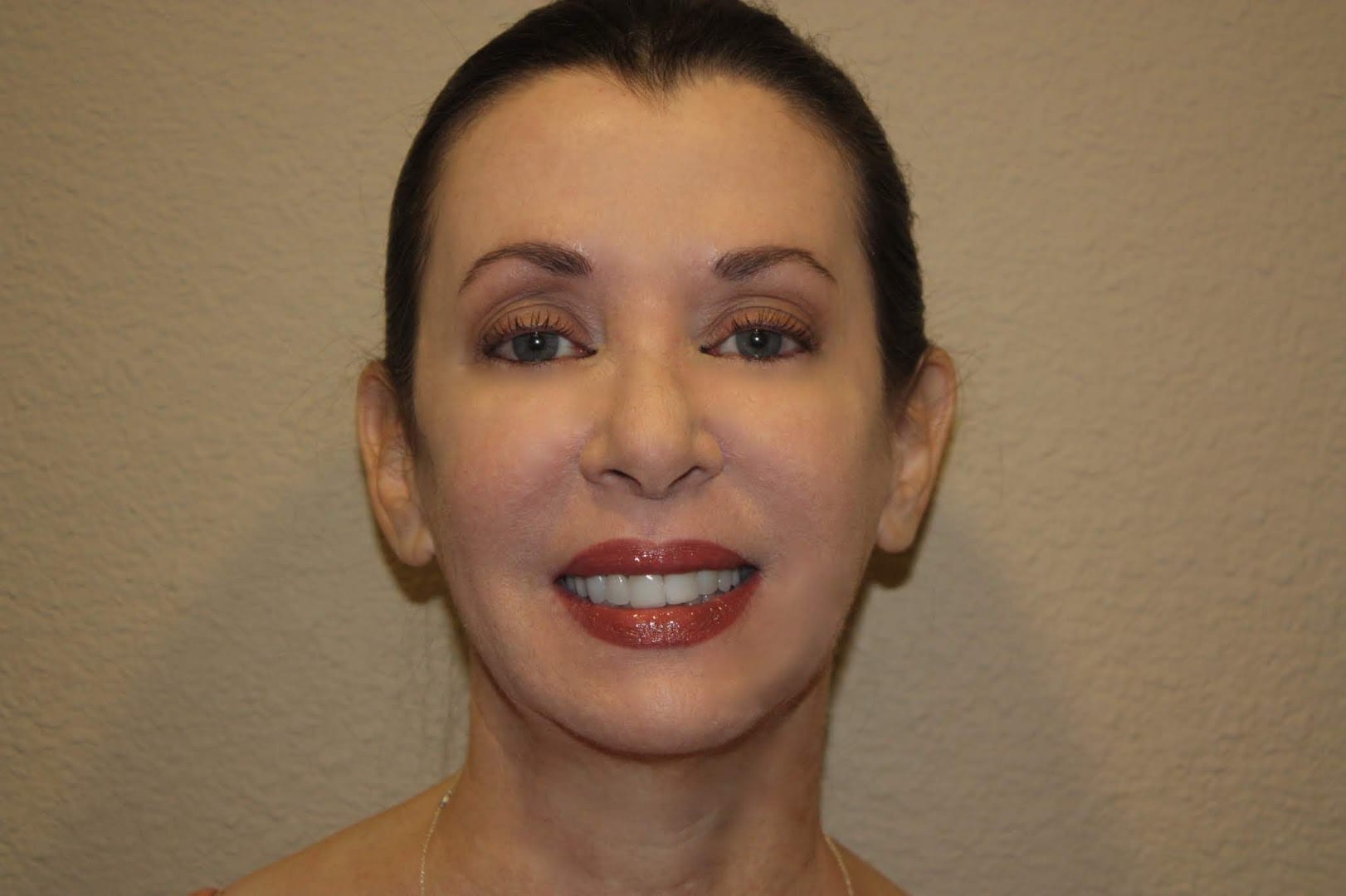 Enhance Dental, photo 2