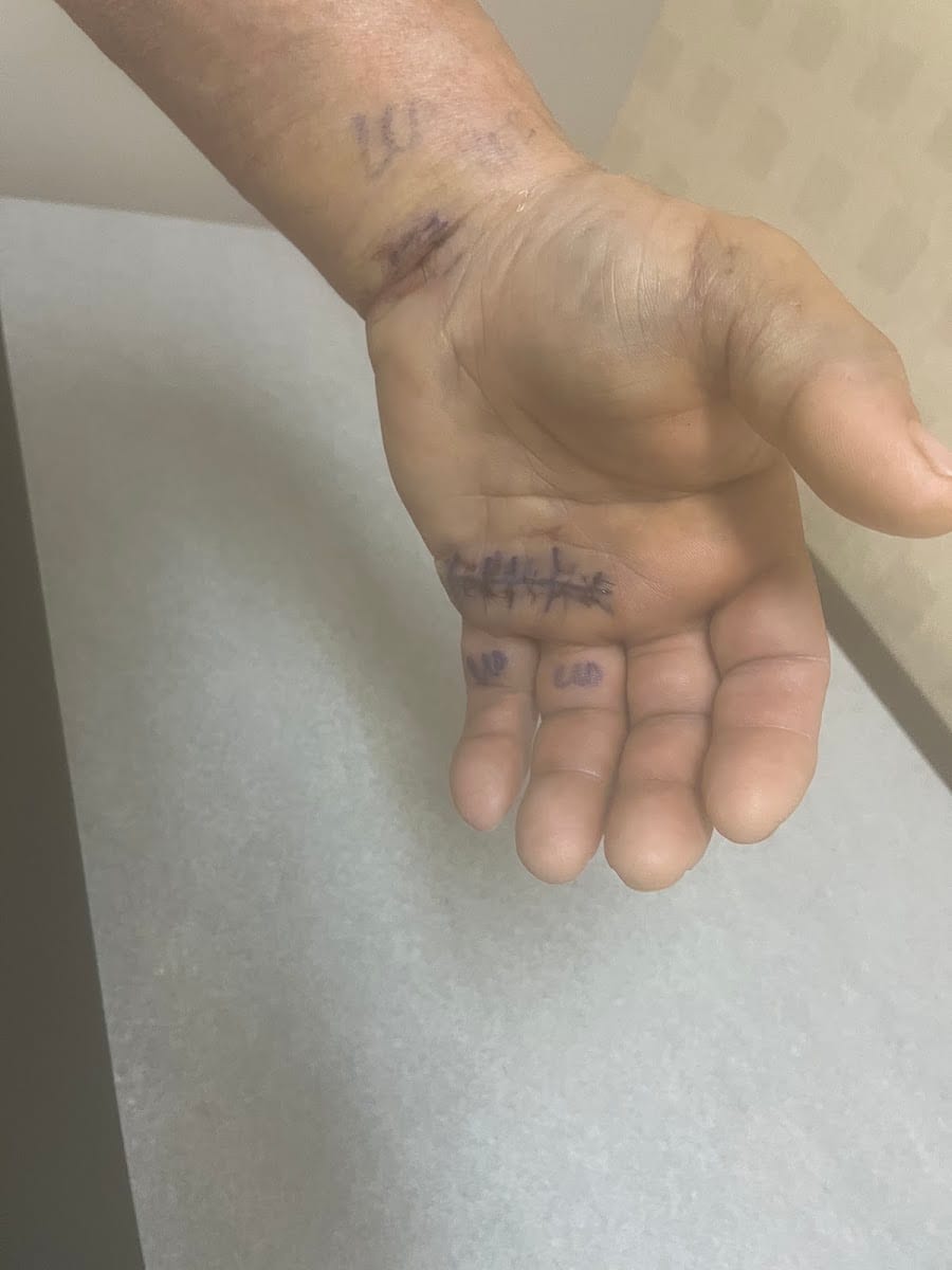 Advance Rehabilitation, photo 4