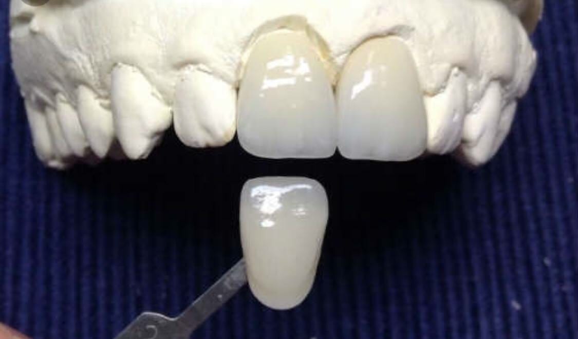 Rogel A Carlos, DDS, photo 4