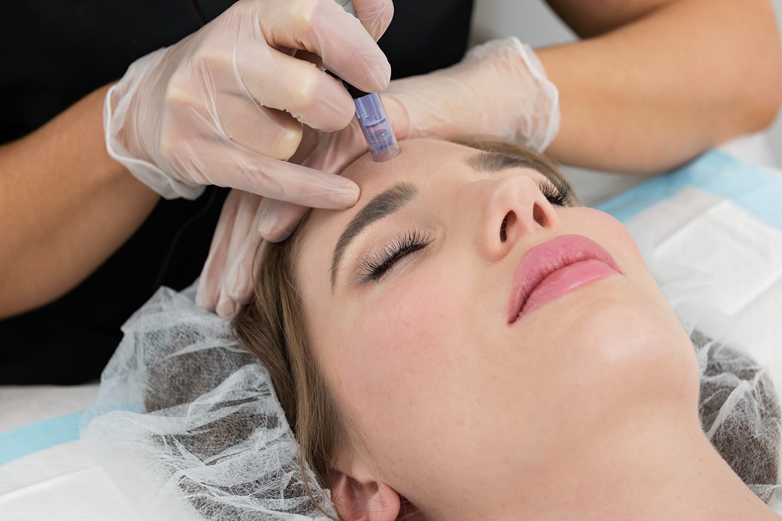 SILK Laser Clinics Mackay, photo 4