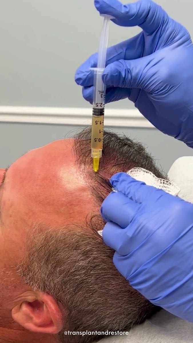 The Hair Transplant & Restoration Center, photo 3