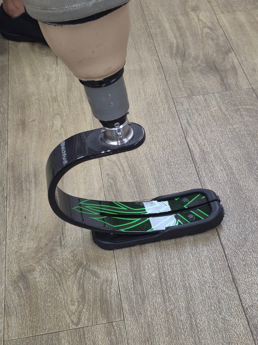 Hanger Clinic: Prosthetics & Orthotics