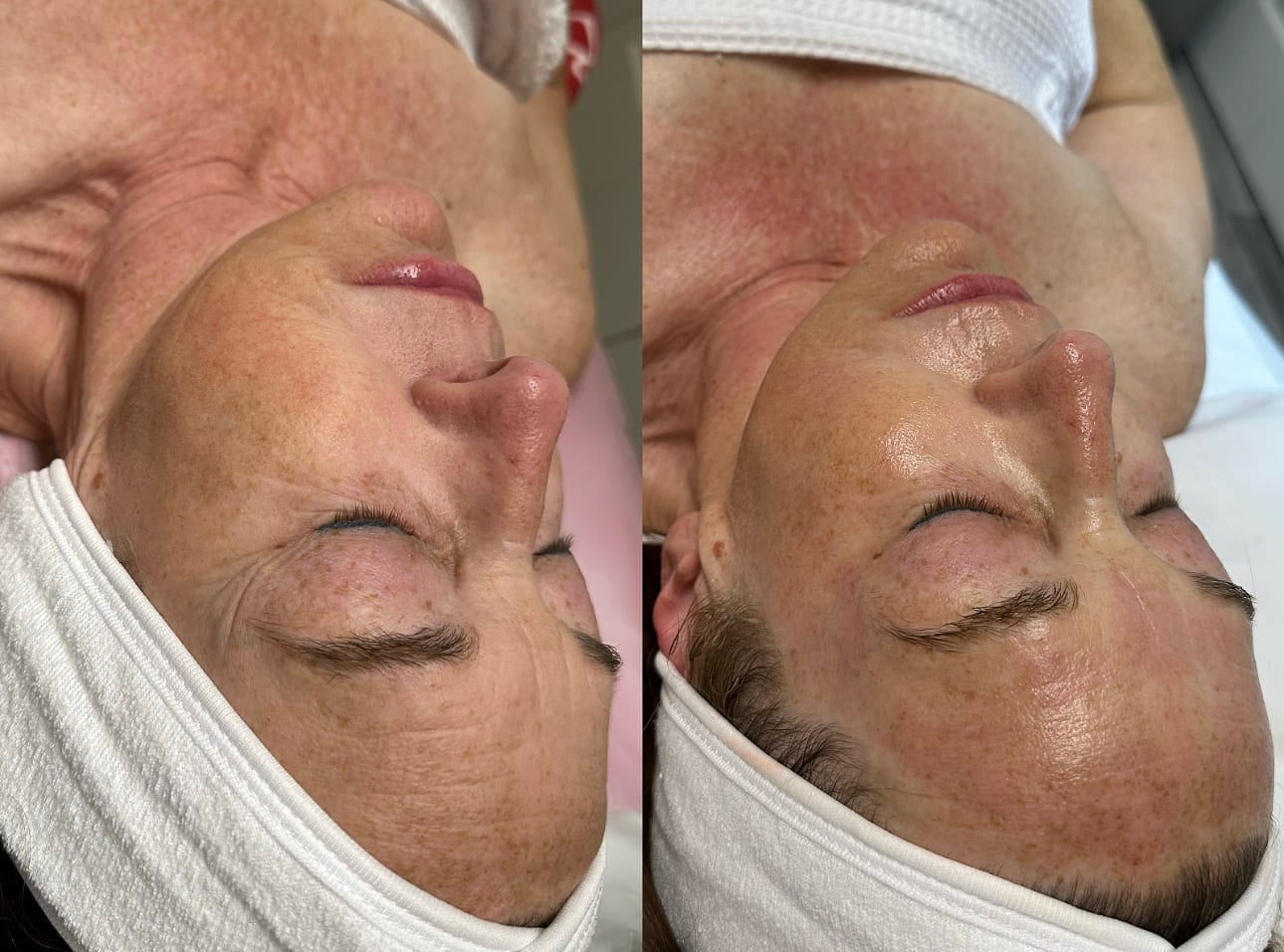 Texas Needle Queen • Botox & Lip Filler Clinic | Round Rock, TX