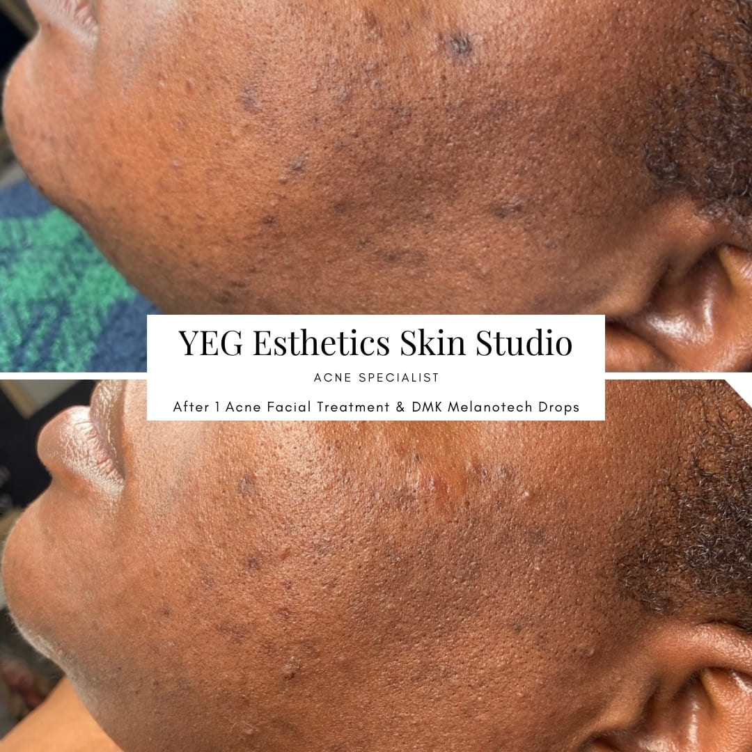 YEG Esthetics Skin Studio, photo 4