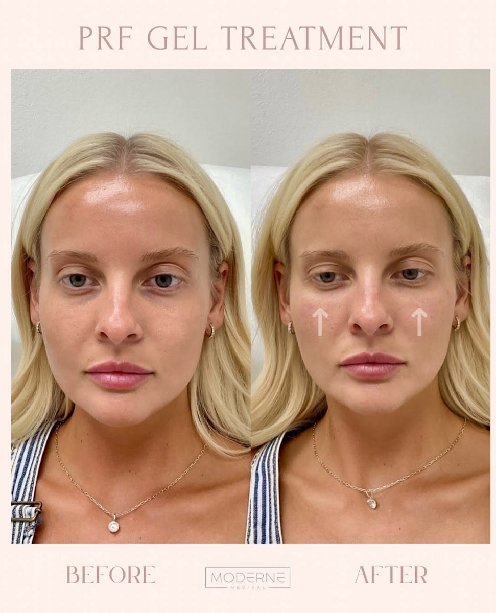 Moderne Medical Aesthetics, photo 4