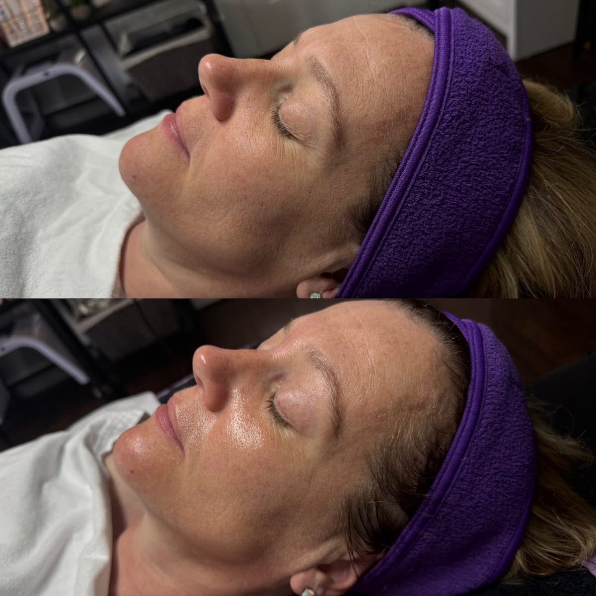 Elysiumskinandbeauty, photo 4