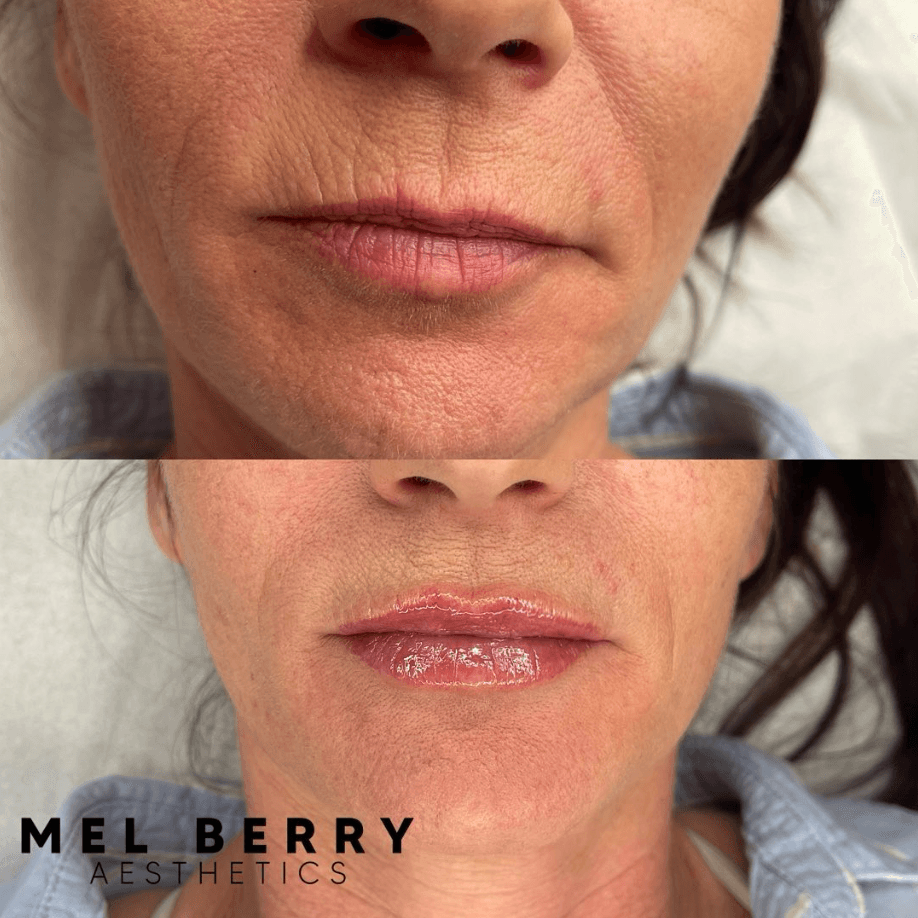 Mel Berry Aesthetics, photo 2