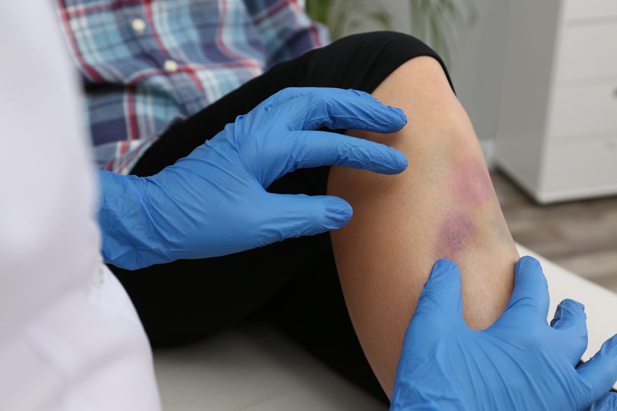 RejuvenX Sarasota - Car Accident Injury Clinic, photo 4