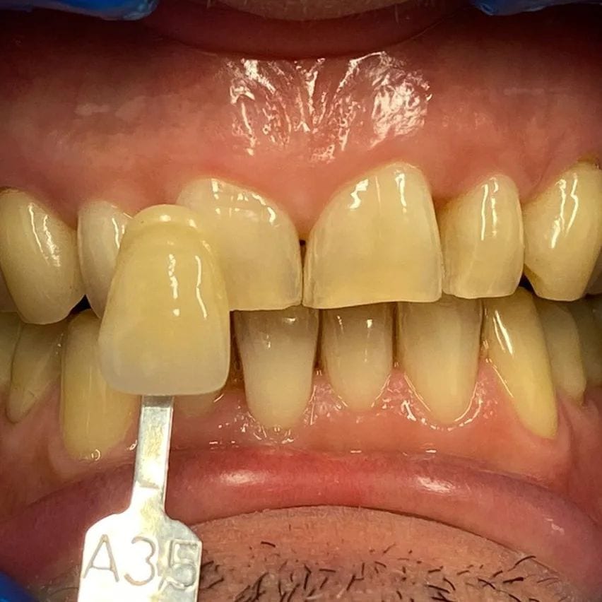 Smiles and Smiles by L&Y Dental City, photo 3