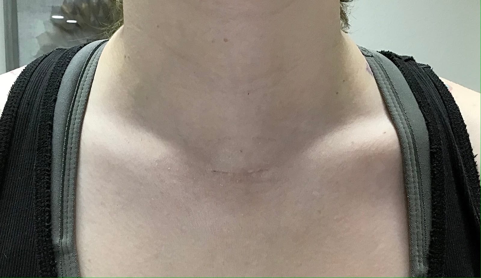 Dr. Bianca Vazquez- Arizona Thyroid & Parathyroid Surgery, photo 4