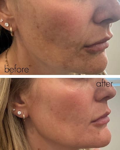 University Park Dermatology, photo 4