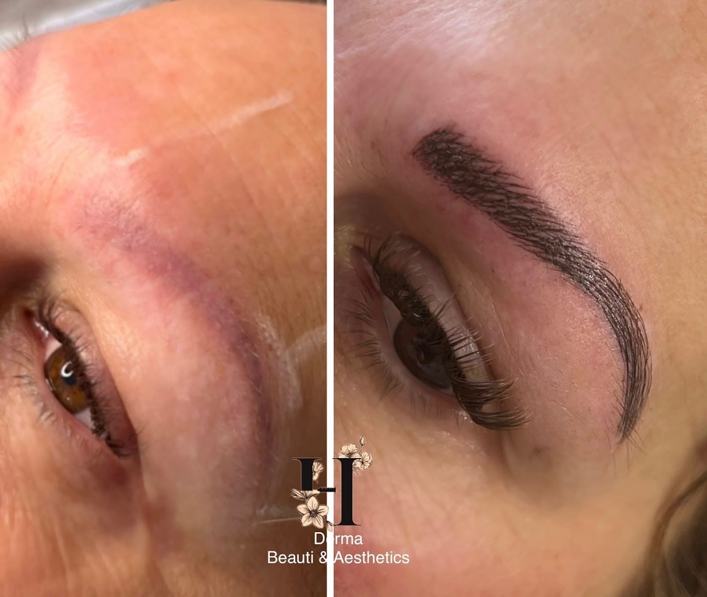 H Derma Beauti & Aesthetics, photo 3