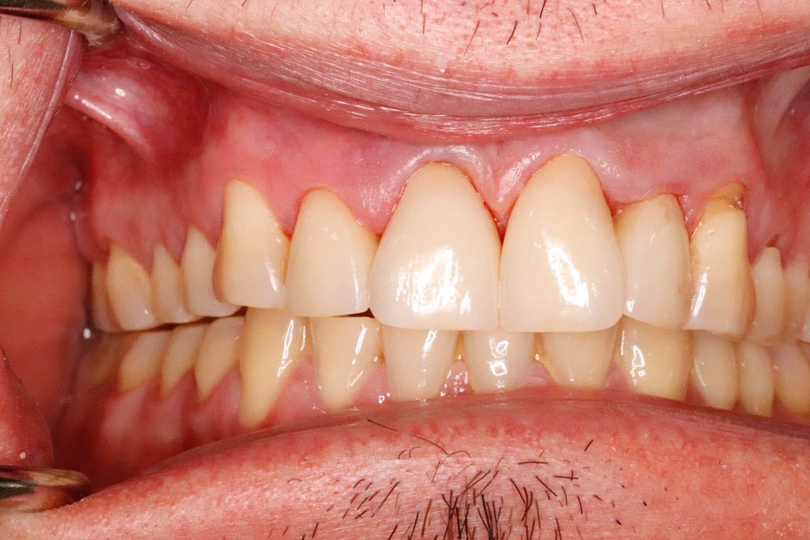 Webber Comprehensive Dentistry - Smithfield