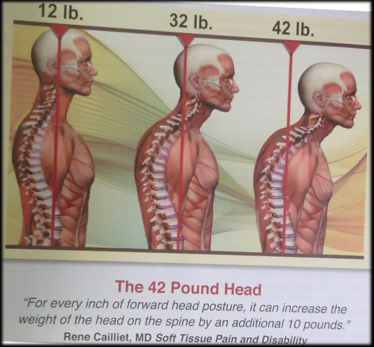 Bowen Therapeutic Bodywork, photo 4