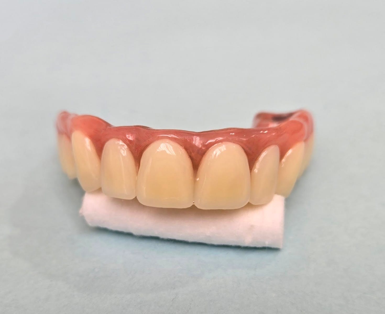 AvaDent Digital Dentures