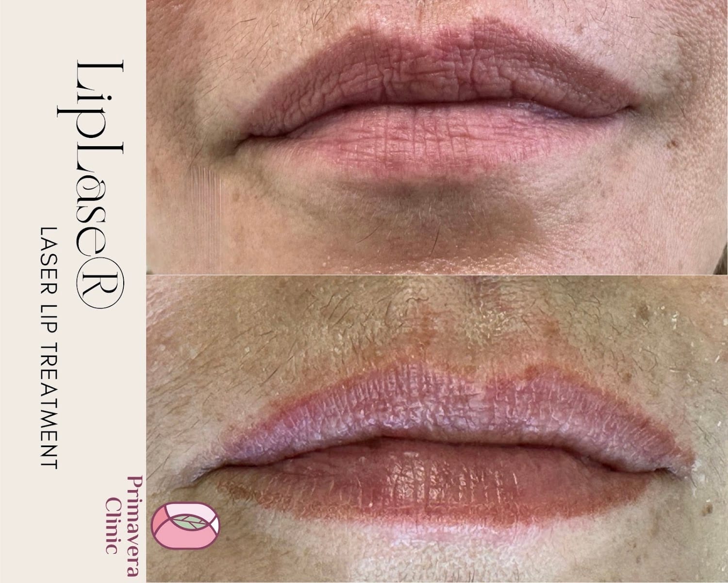 Primavera Cosmetic, Laser and Medical Clinic, photo 3