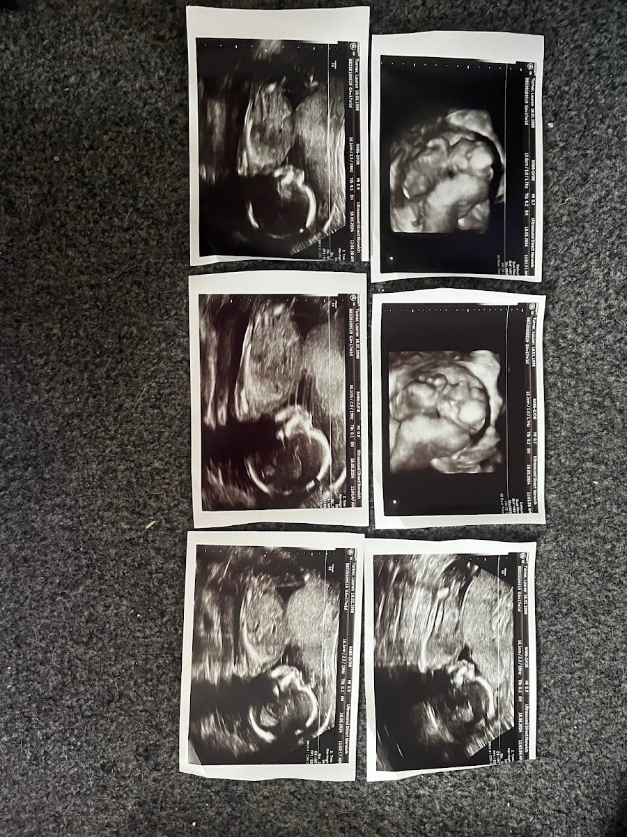 Ultrasound Direct Norwich