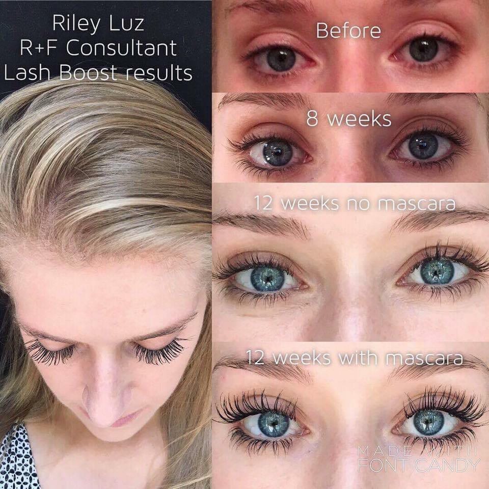Rodan and Fields with Kayla