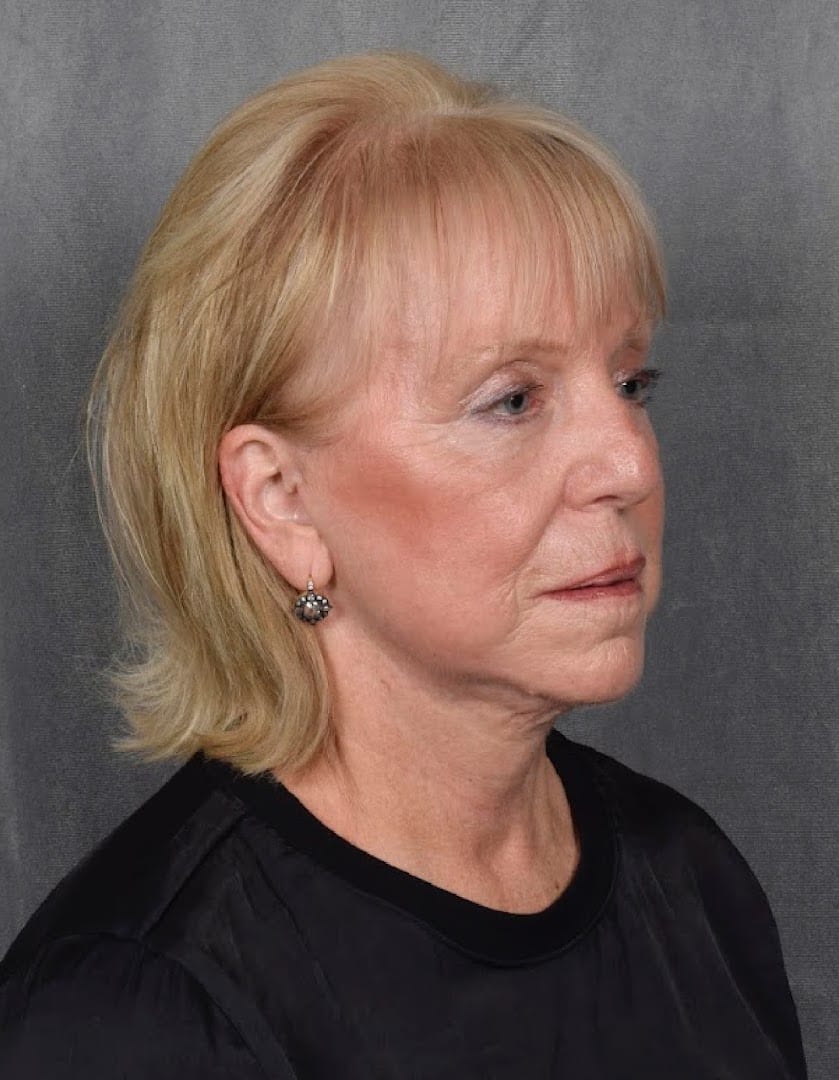 Vegas Facial Plastics - Mehdi Sina MD, MBA, photo 4