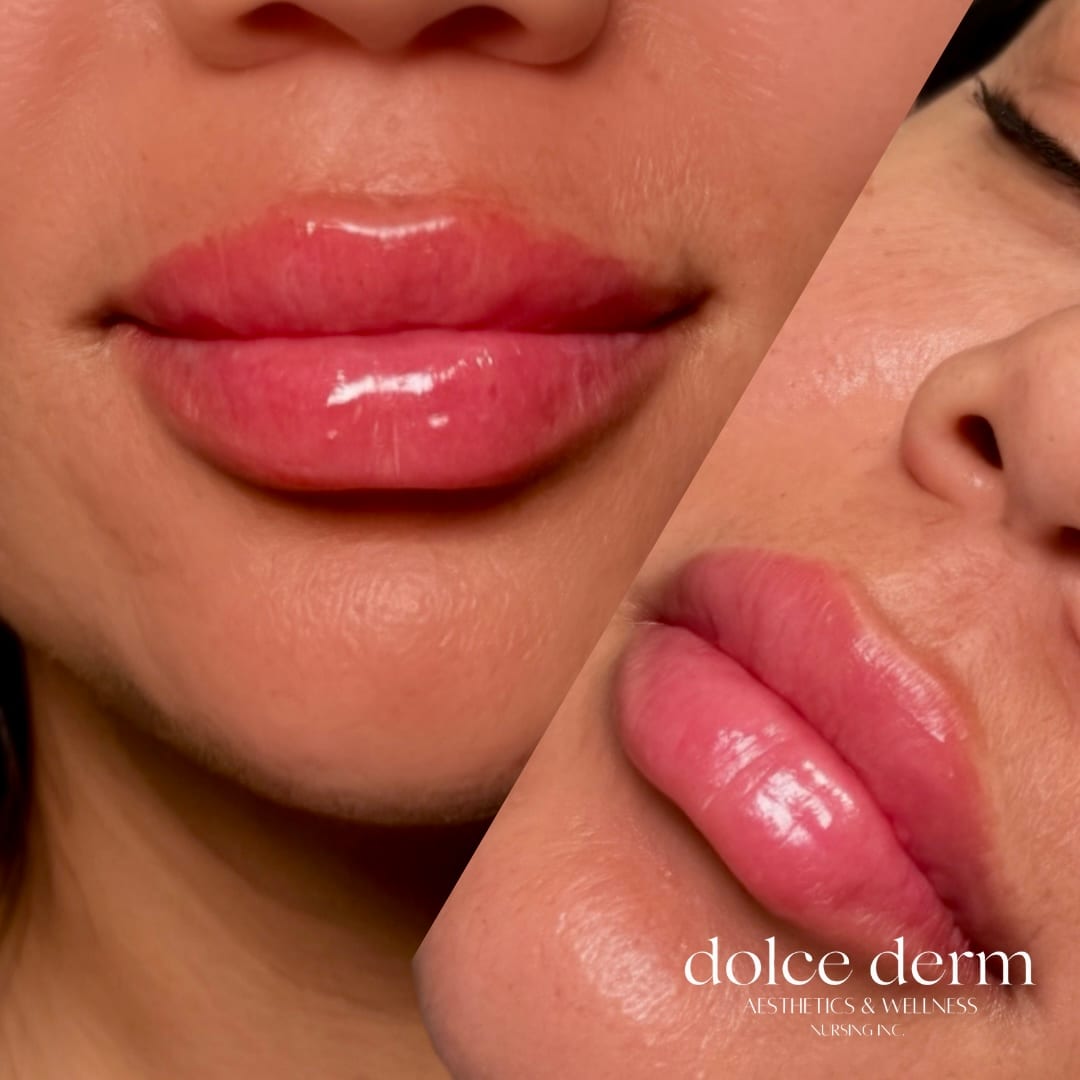 Dolce Derm Aesthetics & Wellness Nursing Inc.