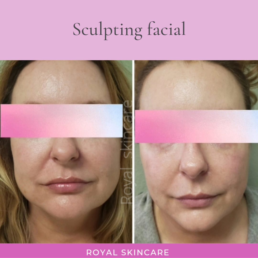 Royal Skincare, photo 3