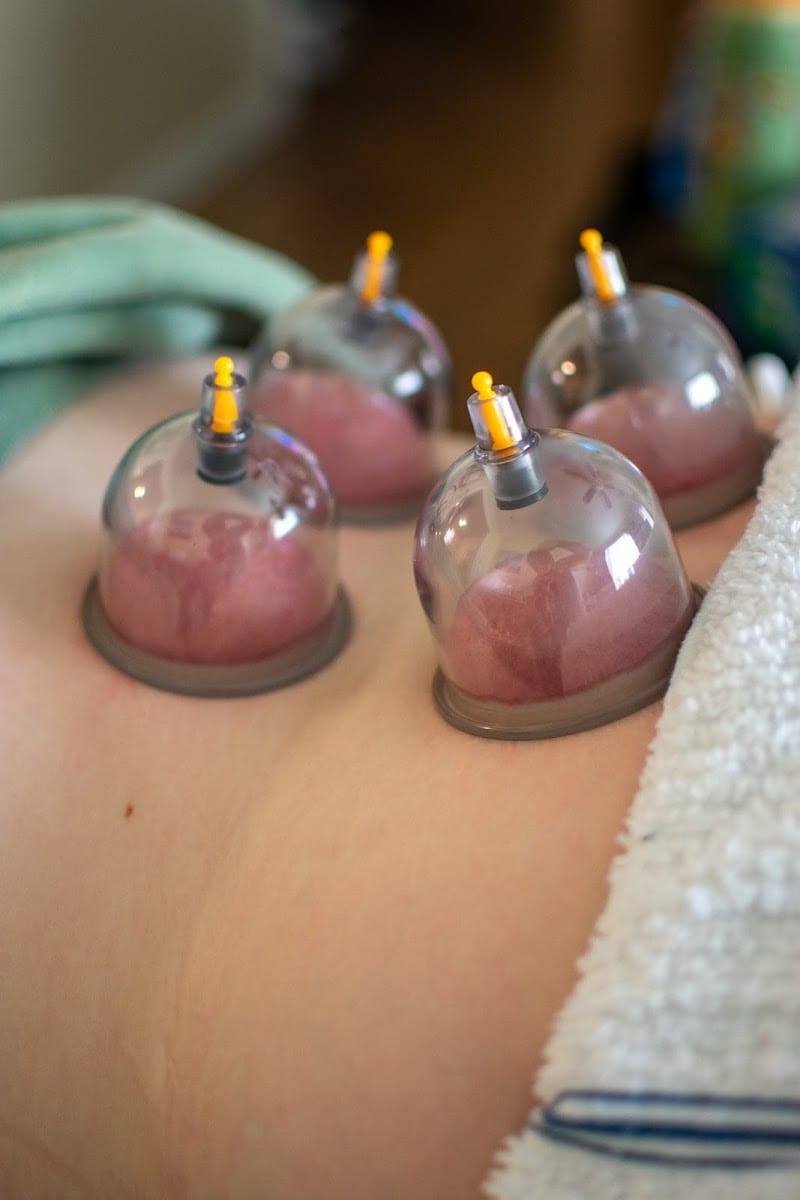 Precision Physical Therapy - Mobile Dry Needling, photo 3