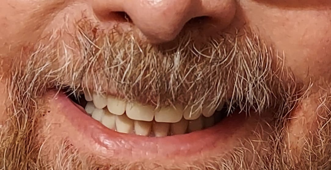 Gattis School Road Dental, photo 4