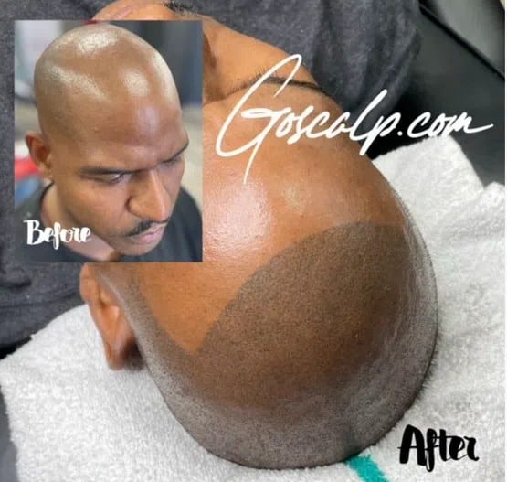 Goscalp Scalp Micropigmentation Hair Loss Center, photo 2