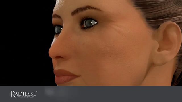 Alladerm, photo 4