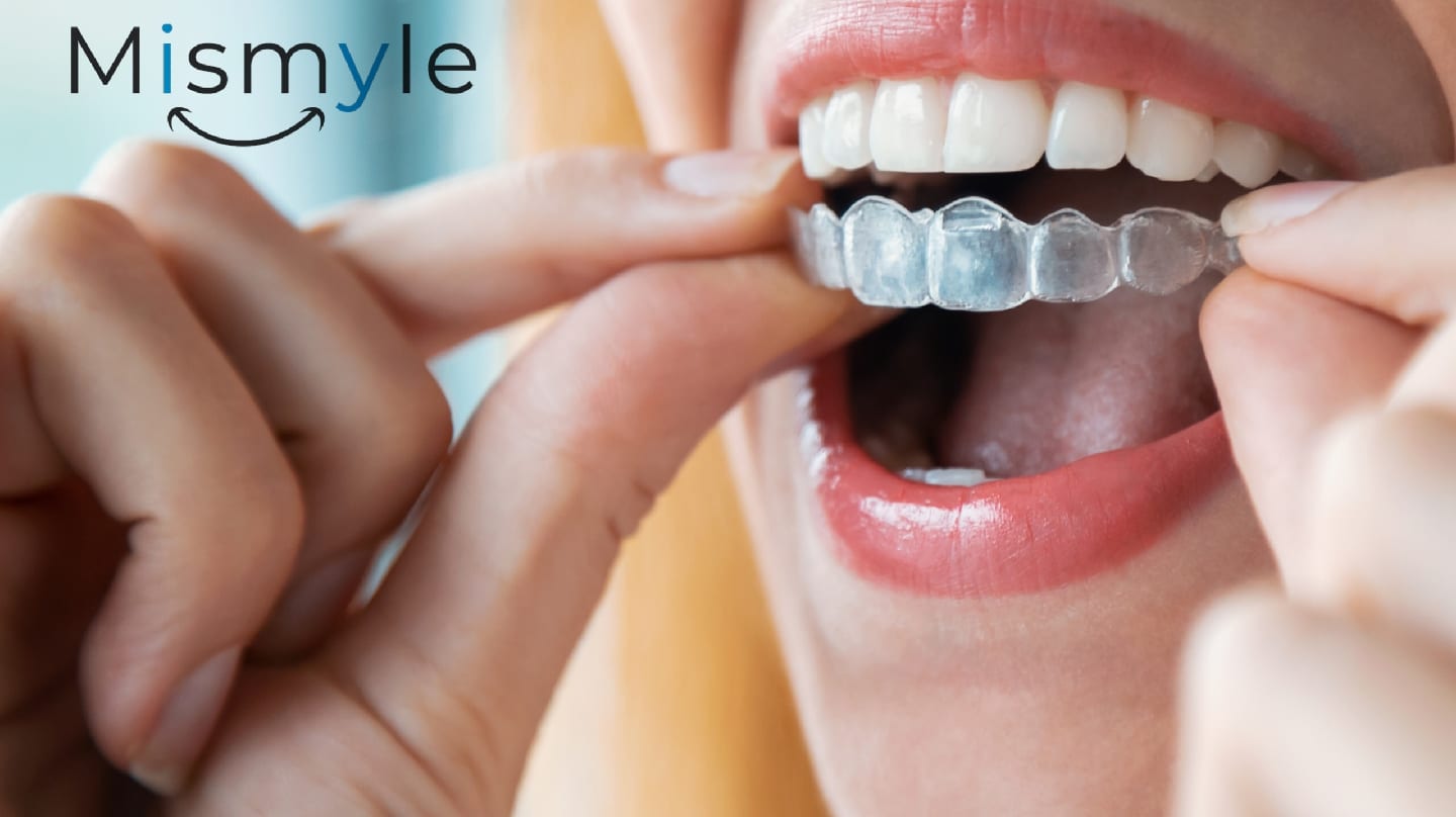 MiSmyle Clear Aligner