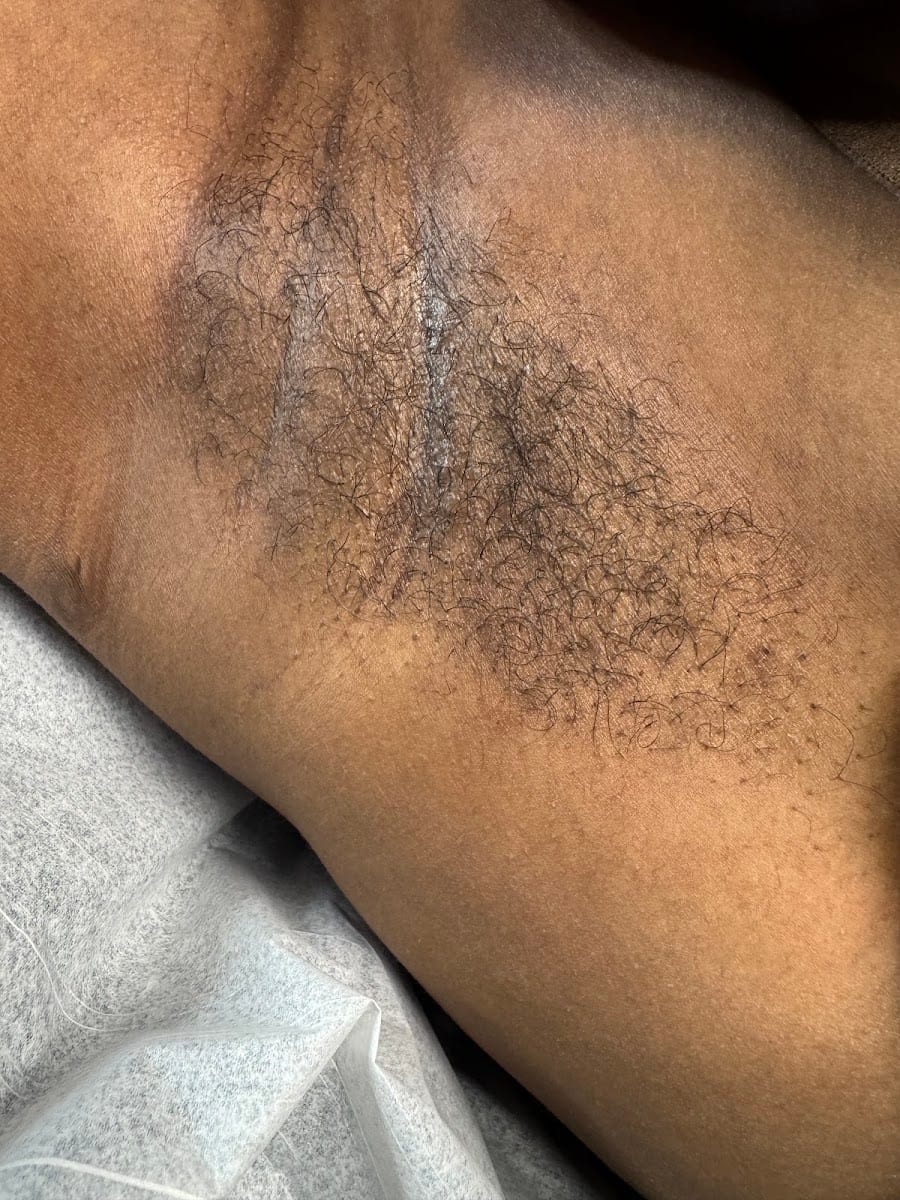 Snatching Bodies Beauti Bar-Hampton Brazilian Waxing, photo 4