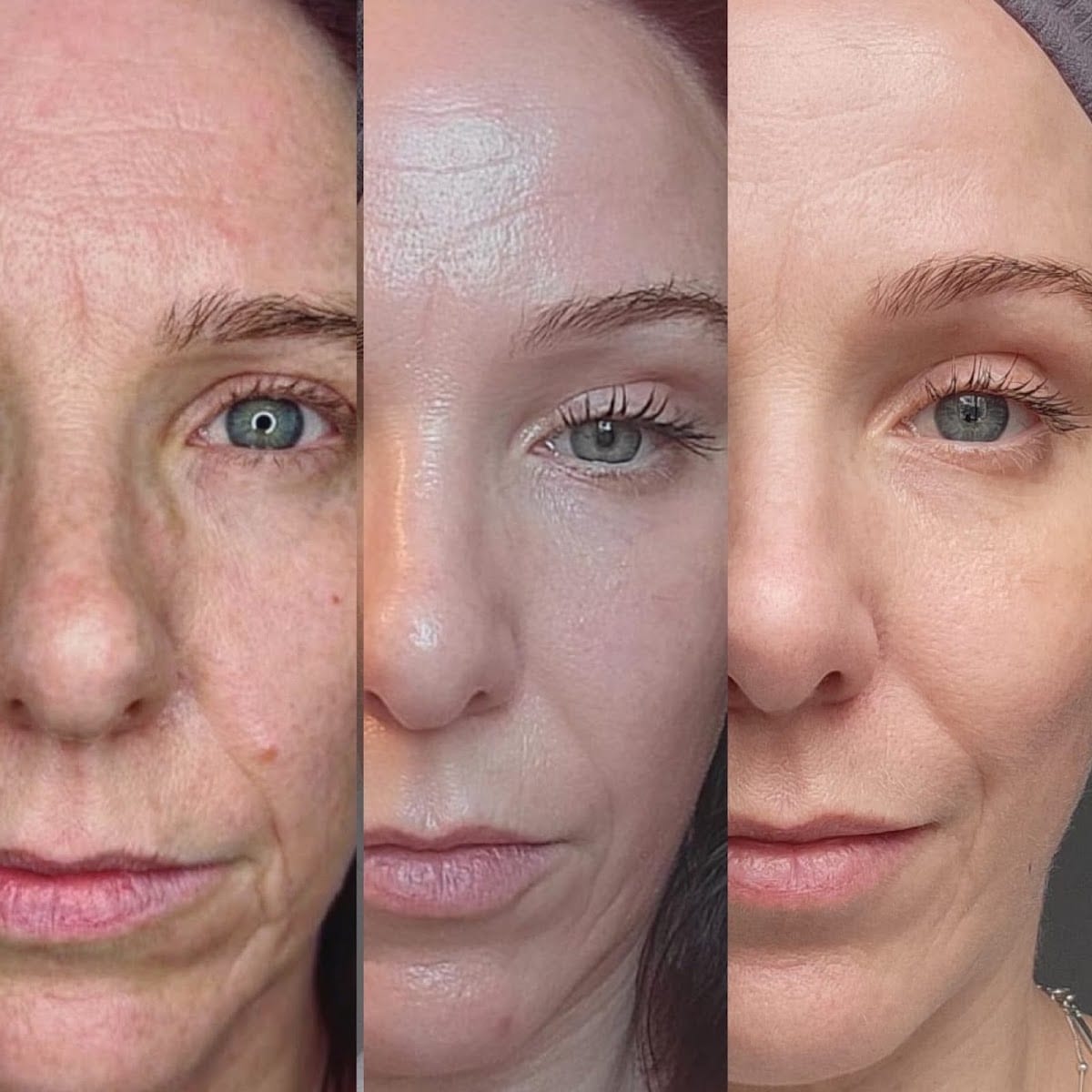 St Albans Smile Studio
